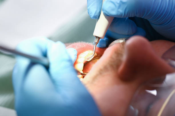 Best Walk-In Emergency Dentist in Bald Kno, AR