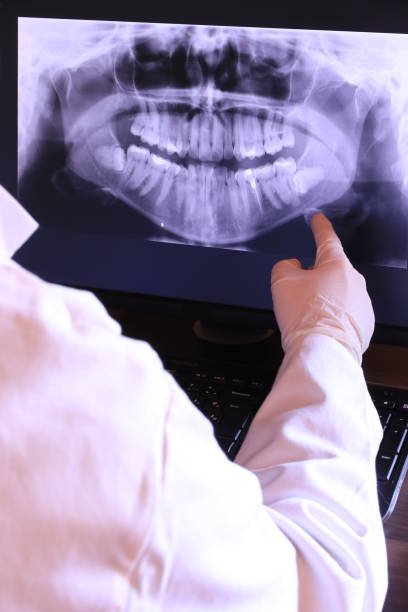 Best Emergency Wisdom Teeth Removal in Bald Kno, AR