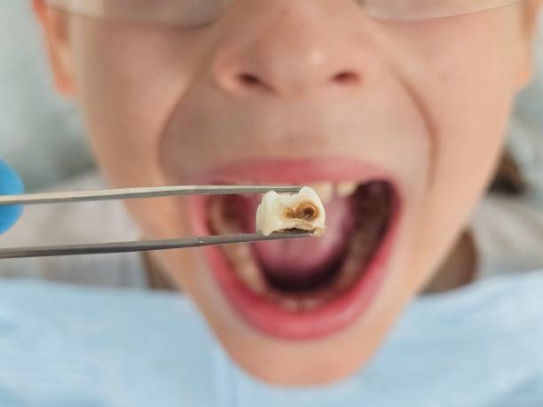 Best After-Hours Emergency Dentist in Bald Kno, AR
